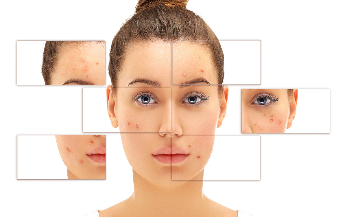 Understanding Skin Pigmentation: Causes, Types, and Treatment